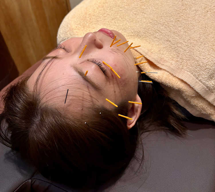 美容鍼や姿勢改善で本物の美しさを!鍼灸整骨院ならではの「美容」メニューをご用意!